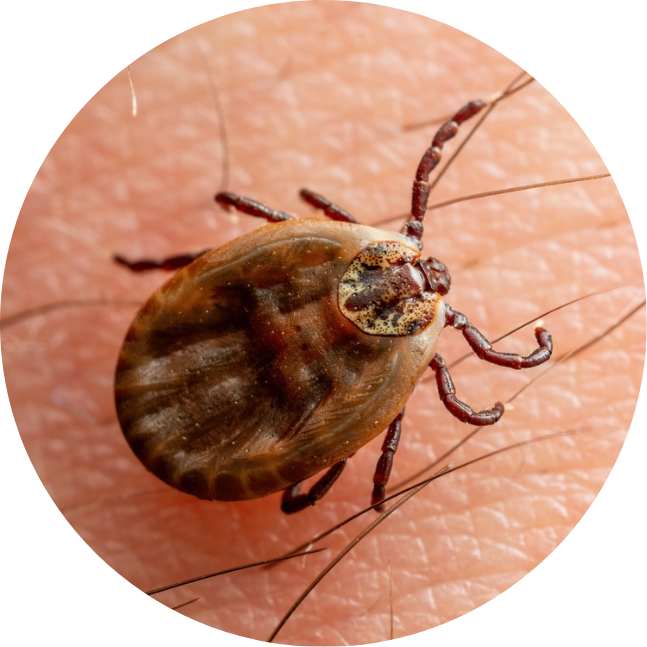 Babesosis Infected Tick